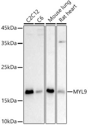 Western Blot: MYL9 AntibodyAzide and BSA Free [NBP2-94899]